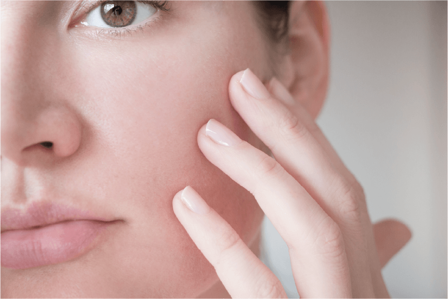 Acne Treatments